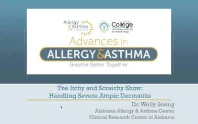 Handling Severe Atopic Dermatitis